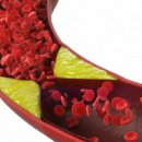 영자피트니스 서초점(골프) 이미지