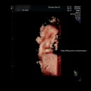 (주)엠에스 | 청주 엠에스여성의원 막달검사 임신 36주 후기