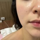 영구농장 | [정왕동피부관리] 구은희에스테틱에서 하이푸 리프팅이랑 폴카RF로 꿀피부 된 후기