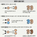 일란성-이란성 `혼합`쌍둥이 출생…사상최초(?) (펌) 이미지