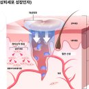 당뇨병 환자들이 ‘EGF’를 찾는 이유, 당뇨발 예방법은? 이미지