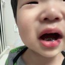 서초서울마더스2성형외과의원 네이버블로그