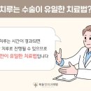 치루개 이미지