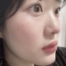 앨브로우