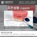 맑은미소치과의원 네이버블로그