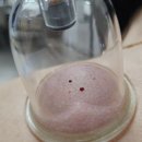만성 염증 통증, 한의과 명의에게 맡기다 - 봉침치료 후기