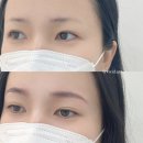 비비드헤어(VIVID HAIR) - 수원시 팔달구 | 창원눈썹문신 비비드아트 처음 받아봤는데 상담부터 달랐어요