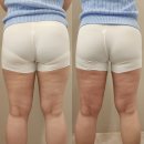 압구정길약국 | 압구정에스테틱 스파유압구정 바디마사지 받고 붓기관리한 후기