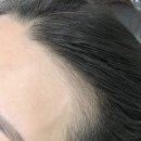 이미지헤어라인 이미지