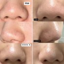 뚜껑열린돼지 | 일소 피지연화제 상세 사용법 + 참존 콘트롤크림 비교, 올리브영 3월 세일 내돈내산 추천템