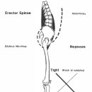 긴장성 약화와 불안정성(tightness weakness and instability) -10년 넘게 고민한 문제의 해답을 찾았다 이미지