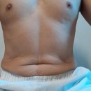 단전호흡스트레칭 Daum카페