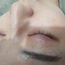 눈에꽃피다