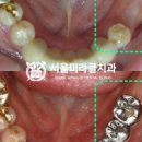 서울보람치과의원 이미지