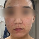 톤즈의원 하남미사점 이미지