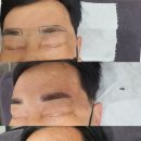 눈썹라라샵 이미지
