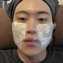 편한마음한의원 | 노원역 한의원 패인흉터 피부과 새살침 4회차 후기