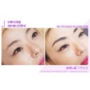 아루다의원 | 부산 아루다반영구클리닉 리얼 후기 인터뷰!!