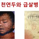 일본 괴질 치사율 최대 70%, 천연두로 대발하면 급살병 터진다 이미지