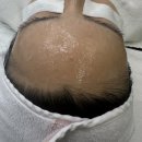 수원 피부 관리) 유주라이크:UZULIKE 스킨플래닝 후기
