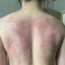 라라메디스킨앤바디 이미지