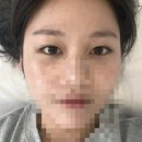 이천속눈썹ㅣ하이닉스 퇴근후 가기 좋은 부발 샵소보로ㅣ 연장같은 바짝 c컬 속펌후기✨