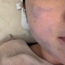 한솔빌딩 | 전주피부관리 [스튜디오한솔] | 전주수분관리 받고 온 후기