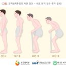 특정관절병척추염 분류표[별표52-1][특정근골격계질환진단보장 특별약관] 이미지