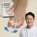 바른발가락 | 무지정렬교정기 바른바레 무지외반증 발가락 교정기 후기