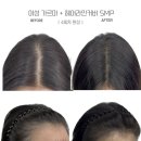 제이린헤어 - 전주시 완산구 세내로 291 | 부산탈모 부산탈모관리 제이린SMP 자연스러운 변화 후기