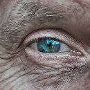 천안제일의원 | 피부과 유목민 생활 청산했어요! 천안엘츠의원 완전 솔직 후기