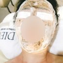 토탈아쿠아솔루션 | 성동 디유에스테틱ㅣ왕십리 피부관리 전문 에스테틱 2B알라딘 필링 후기