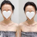 광주에스테틱 윤곽관리 전문 &#39;에스테티아 첨단1호점&#39;