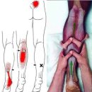 시원한이성수마취통증의학과의원 | 발바닥 통증 원인? 안양 만안구 도수치료 15년차 베테랑의 명쾌한 분석과 후기