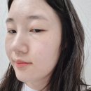 피지연화앰플 추천 조유리앰플 셀라딕스 세범 리밸런싱 알엑스 131앰플 후기