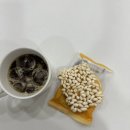 마리엠산부인과의원 | 미레나 후기 마지막4_6개월 후의 변화