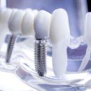 자연치과기공소 이미지