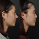 마이티성형외과의원 이미지