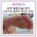 [육아일기] 5세 아이 발바닥 찢어진 상처 봉합수술 - 주말 응급실 진료 후기