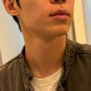 강남-100 | 강남역 쥬베룩볼륨 후기, 팔자주름 치료 100% 해결가능