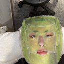 압구정 루나의원, 루비레이저 후기