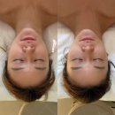 티아라피부관리실 | ［ 강남 / 청담 ] 강남티리온엑스 받으러 간 청담피부관리 엘바이세븐 후기