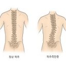 '스타킹' 이특, 교통사고로 척추측만증..'복근도 비뚤' 이미지