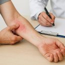 수양빌딩 | 부산지루성피부염치료 후기에 의존하기 보다는