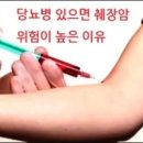 당뇨병 있으면 췌장암 위험이 높은 이유 이미지