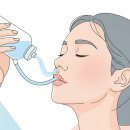 알레르기 비염, 생리식염수 코 세척의 올바른 방법과 농도 이미지