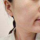 연아코스메틱 펩타힐세럼 건성, 홍조, 진정 세럼 일주일 사용 후기