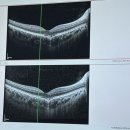 우안과의원 이미지