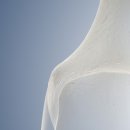 사월수정형외과의원 네이버블로그