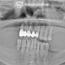 주안시카고치과의원 네이버블로그